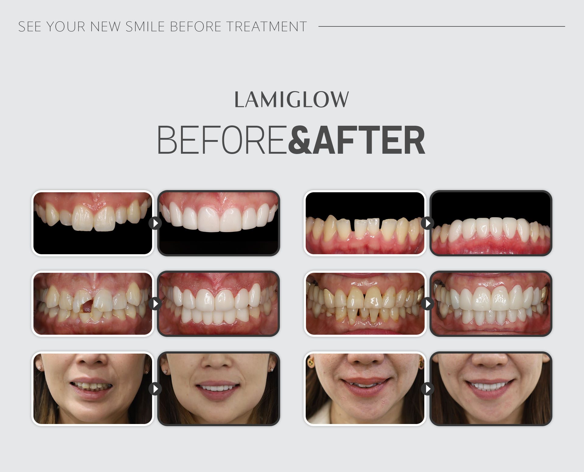 LAMI-GLOW before and after