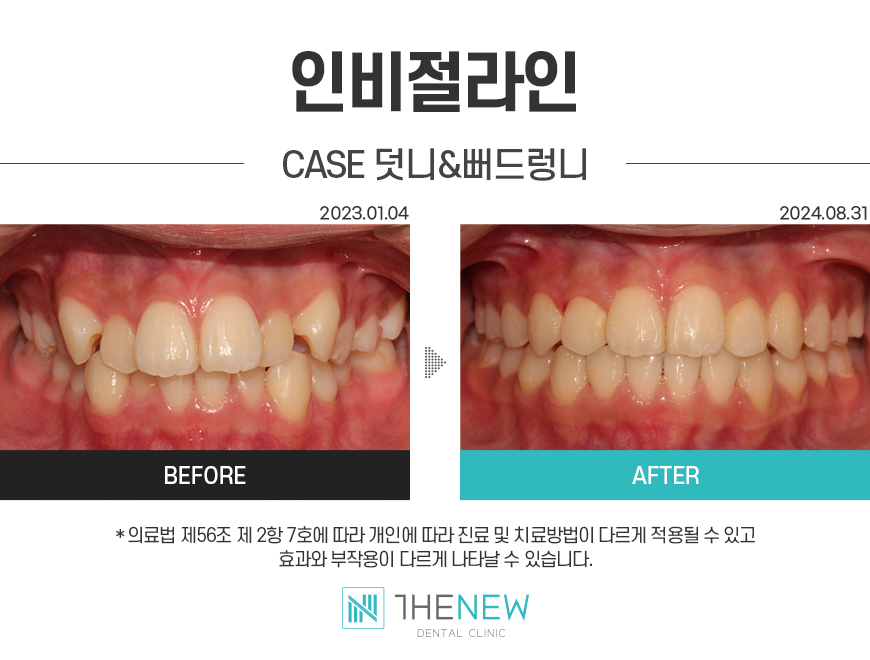 업로드된 이미지