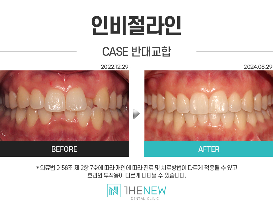 업로드된 이미지