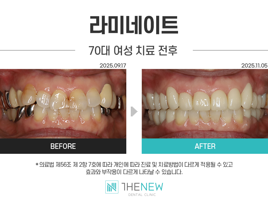 업로드된 이미지