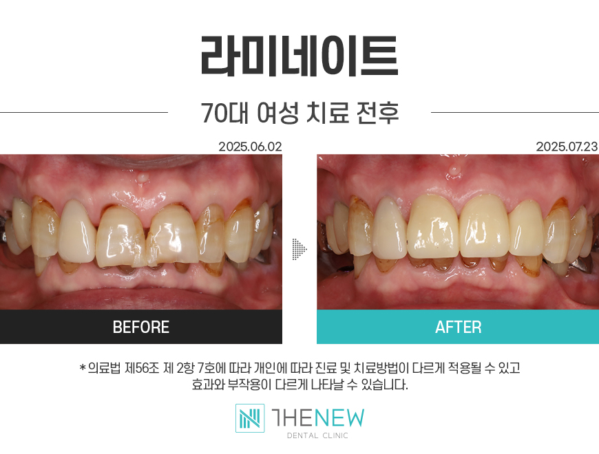 업로드된 이미지